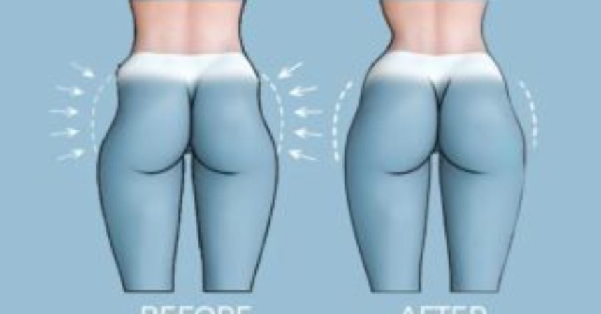 Some essential things to know about hip dips