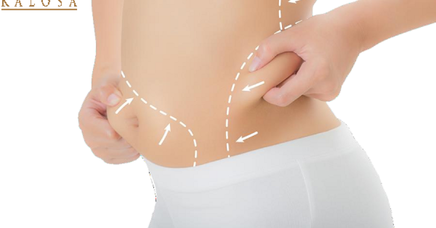 liposuction surgery